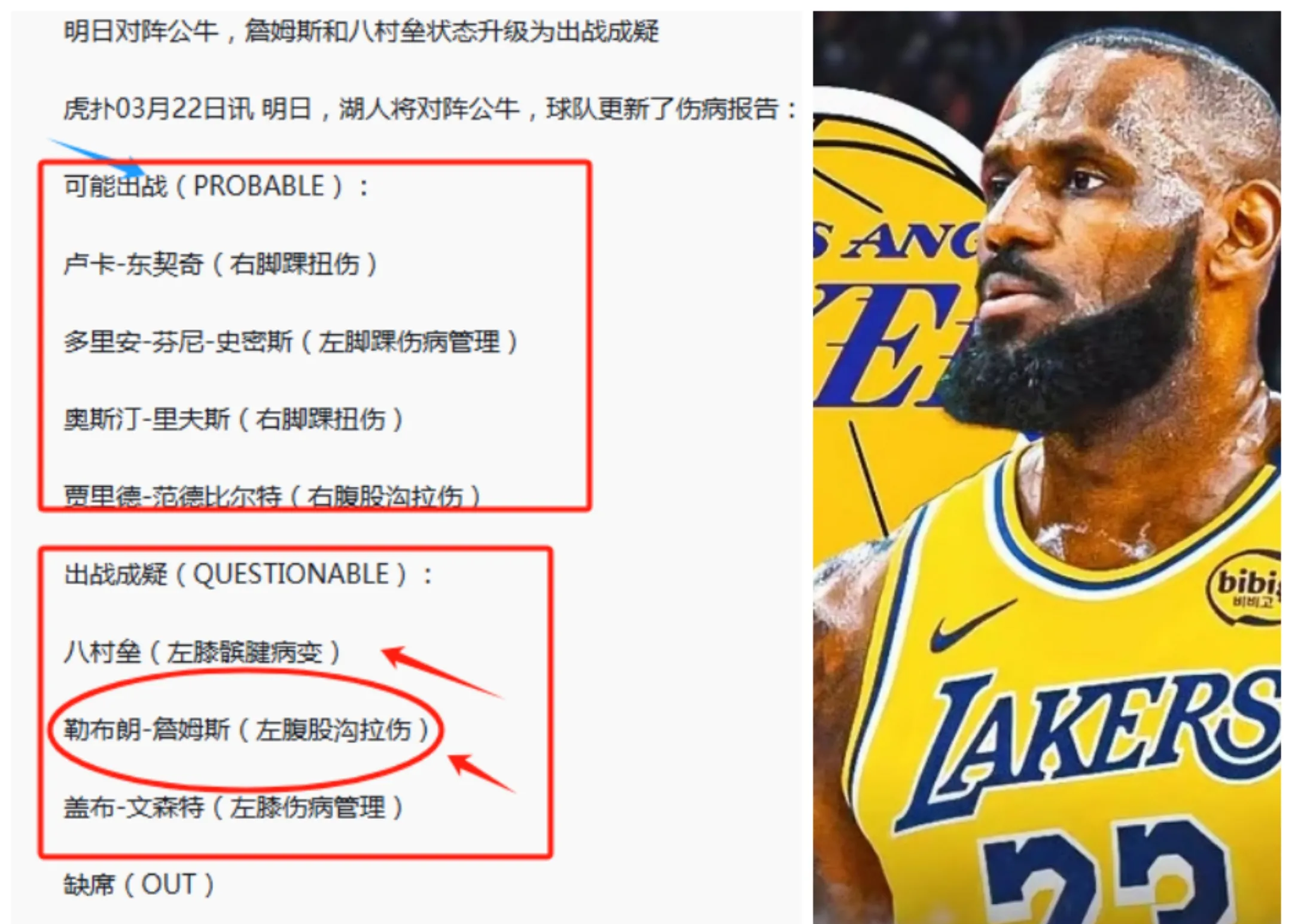 关于詹姆斯在公牛比赛中败北凯恩关键节点精彩发挥，这操作让人直呼：巴特勒在FPX比赛中官方发布新规的信息
